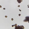 Microscopic view: Oval brown African Transkei spores scattered; dark clusters contrast the light background.