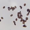 Microscopic view: Huautla spores, oval, dark-edged with pale centers, seen clustered and scattered on a clear slide.