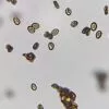 Micrograph of Colombian Rust Spores: dark ovals with distinct patterns on a bright background; vary in size/shape.