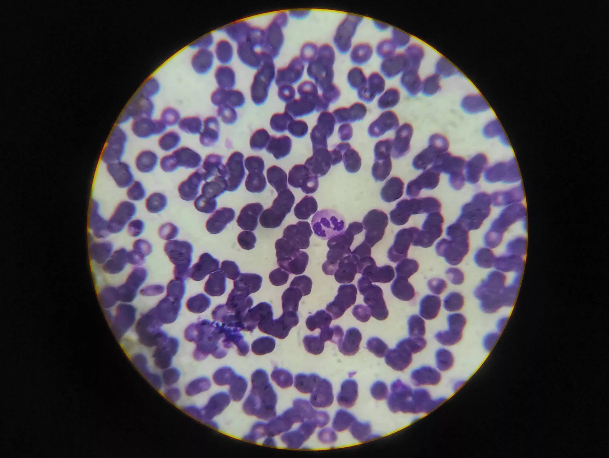 psilocybin cellular aging study